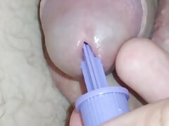 insertion of the pointed reamer into the dick channel.