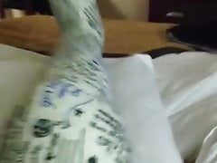 My leg cast