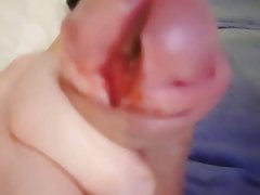 Cumming with my subincision cock with splitted cock head